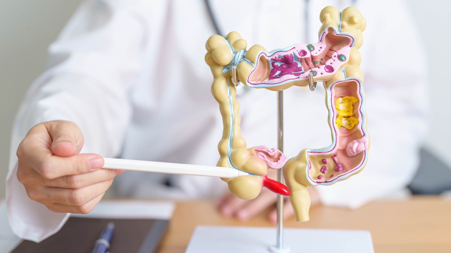 Colorectal Cancer Risk: Age & Family History