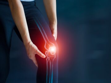 شرح التهاب المفاصل Osteoarthritis: مرض مفصلي تنكسي يسبب الألم والتيبس وانخفاض الحركة، مما يؤثر على الأنشطة اليومية.
