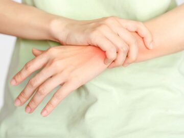 Understanding Rheumatoid Arthritis: Chronic inflammatory disorder affecting joints, causing pain, swelling, and mobility issues.