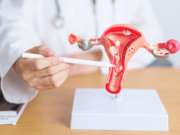 Myofol Plus is a dietary supplement that enhances ovarian health, regulates the menstrual cycle, and supports fertility and achieving pregnancy