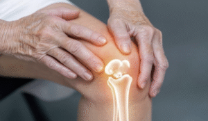 Knee joint pain relief with VitaCed Osteo Max effervescent tablets