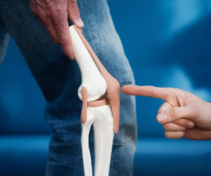 Healthy bones supported by calcium and vitamin D3 supplement VitaCed® Joints